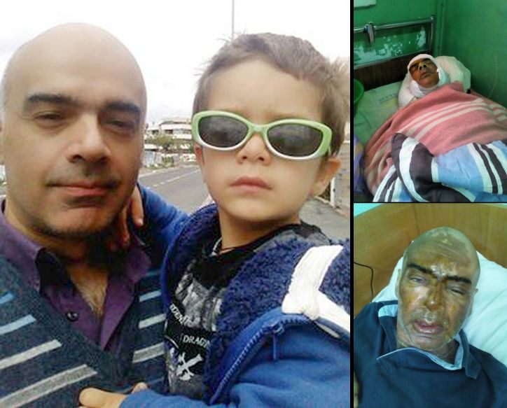 Vater Giovanni - vor und nach dem Säureanschlag von Odessa